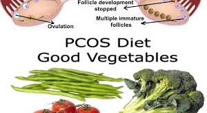 Poly cystic Ovarian Syndrome (PCOS)