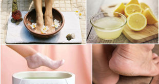 Here Are Some Natural and Useful Ways To Smooth Your Cracked Heels