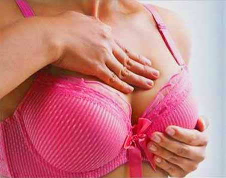 Breast Cancer: Symptoms, Treatment, and Prevention