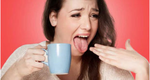 Home Remedies For Burnt Tongue