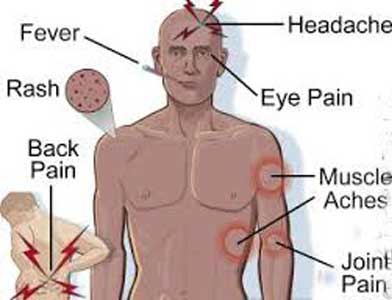 Causes of Viral Fever