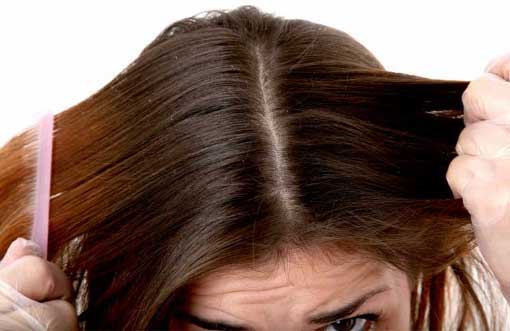 Get Rid Of Dandruff Quickly