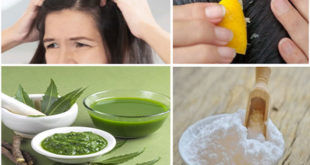 Best Home Remedies For Treating An Itchy Scalp