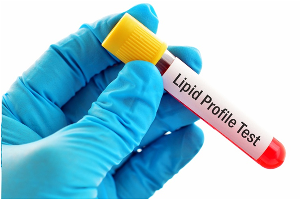 Lipid Profile Test 