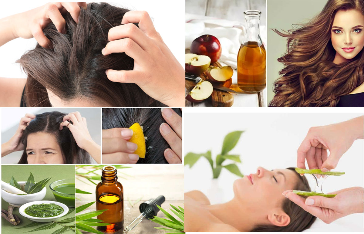 Effective Home Remedies for an Itchy Scalp