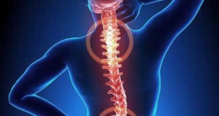 What is Back Pain:Causes, Signs and Symptoms,Risk Factors, Nature Cure