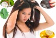 Top 12 Simple Home Remedies that work Wonders for Dandruff Treatment