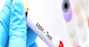 Have you heard of hormone anti-mullerian hormone test?